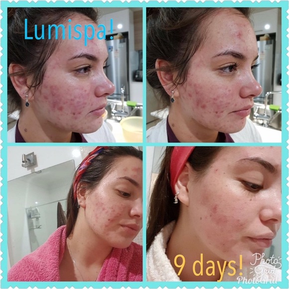 LumiSpa NuSkin - Best cleansing device - Picture 4 of 7